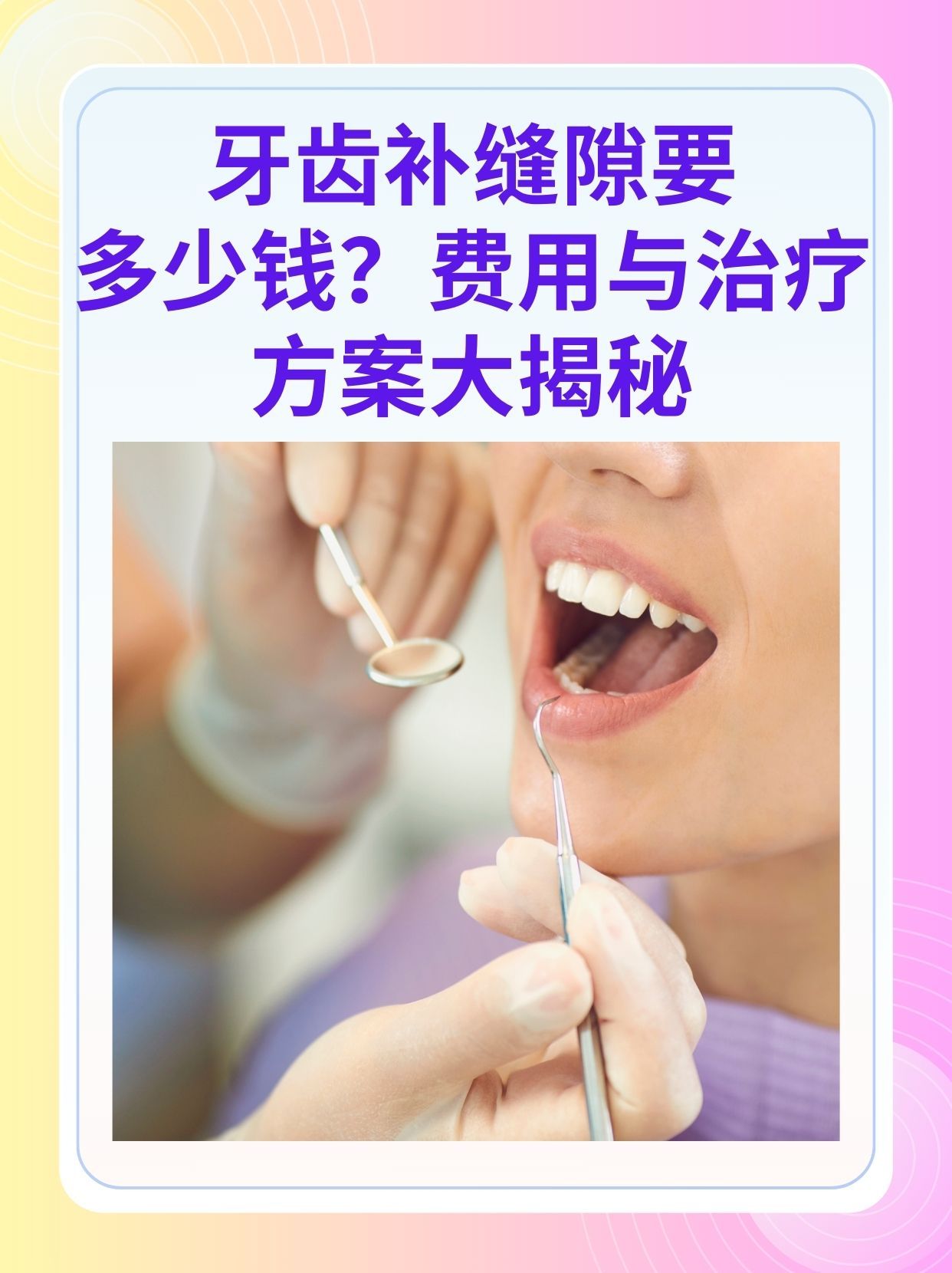 太原补牙医保可以报销吗(补牙医保可以报销吗 哪些可以报销呢)